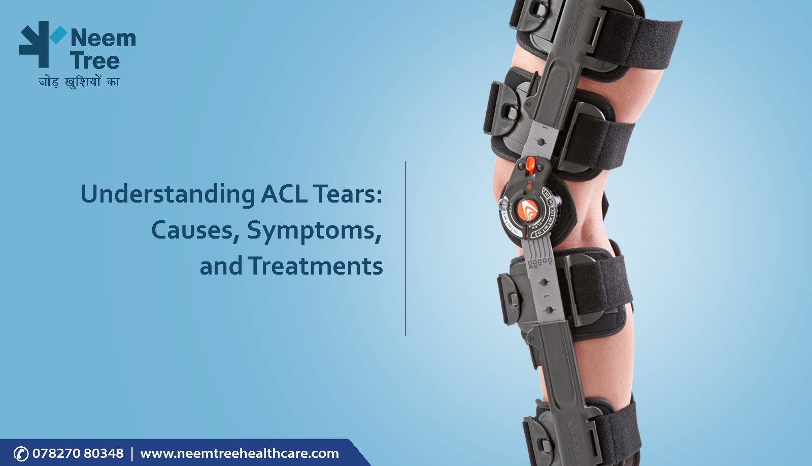 Understanding ACL Tears