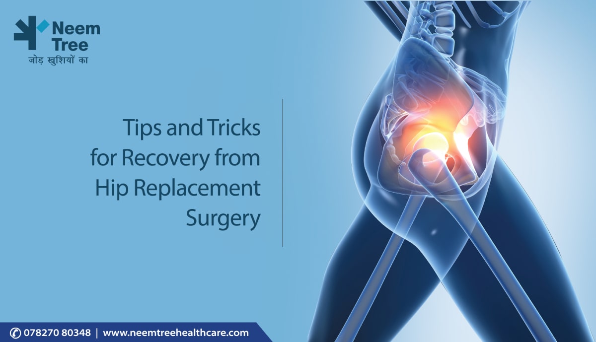 Tips and Tricks for Recovery from Hip Replacement Surgery
