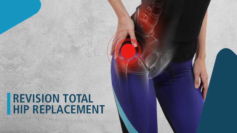 best total hip replacement in West Delhi